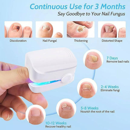 Nail Fungus Removal Treatment Cleaning Laser Therapy Device Toenail Fingernail