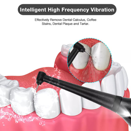 Electric Ultrasonic Tooth Stains Dental Scaler Tartar Calculus Plaque Remover