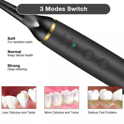 Electric Ultrasonic Tooth Stains Dental Scaler Tartar Calculus Plaque Remover
