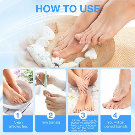 Fungal Nail Laser Treatment Device Highly Effective Kill Toenail Beriberi Fungus