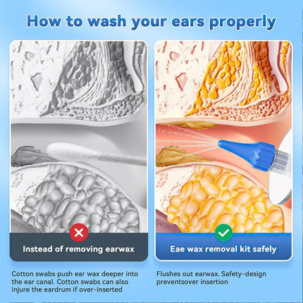 Ear Wax Removal Kit  Safe Irrigation Cleaner with Syringe for Easy Ear Cleaning