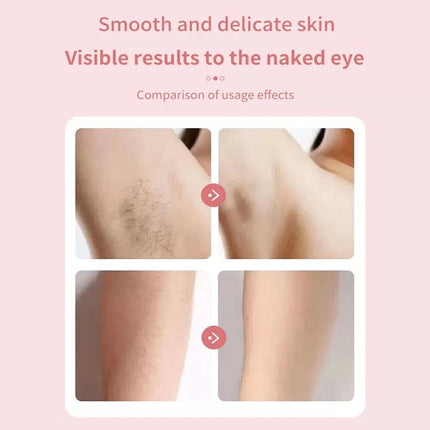 Dual Head Shaver Women, Electric Bikini Trimmer, Wet & Dry Use Hair Removal