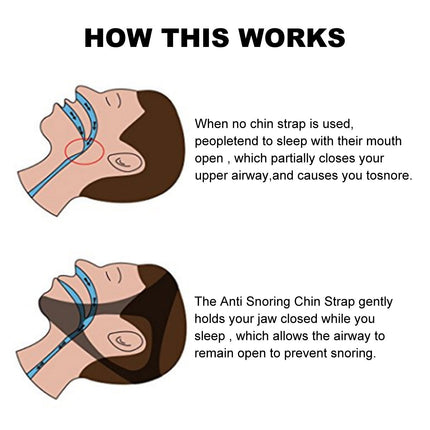 2pcs Anti Snoring Sleep Apnea Aids Splendid&Co.