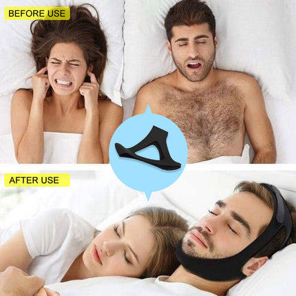 2pcs Anti Snoring Sleep Apnea Aids Splendid&Co.