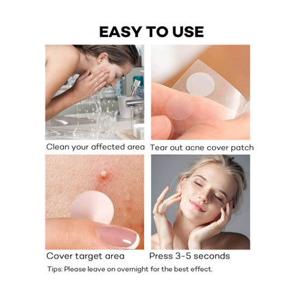 36 Pcs Acne Pimple Patch Splendid&Co.