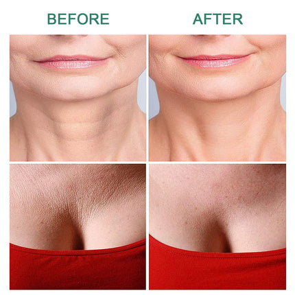 Reusable Anti Wrinkle Skin Chest Neck Eye Face Pad Silicone -11pcs Splendid&Co.